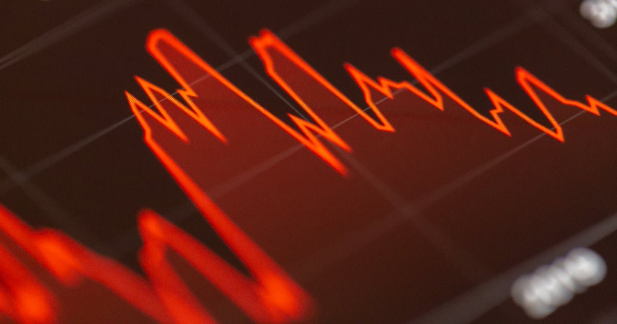 A stock market graph